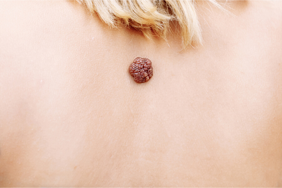 Operative-Dermatologie